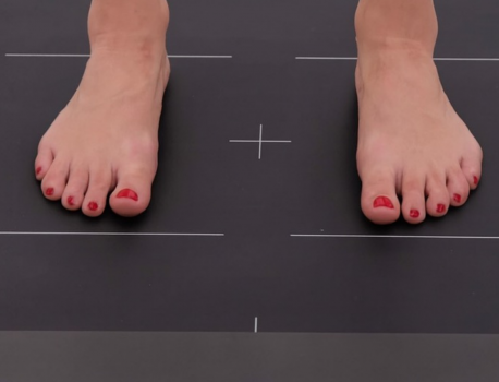Ritrova l’equilibrio con la pedana baropodometrica